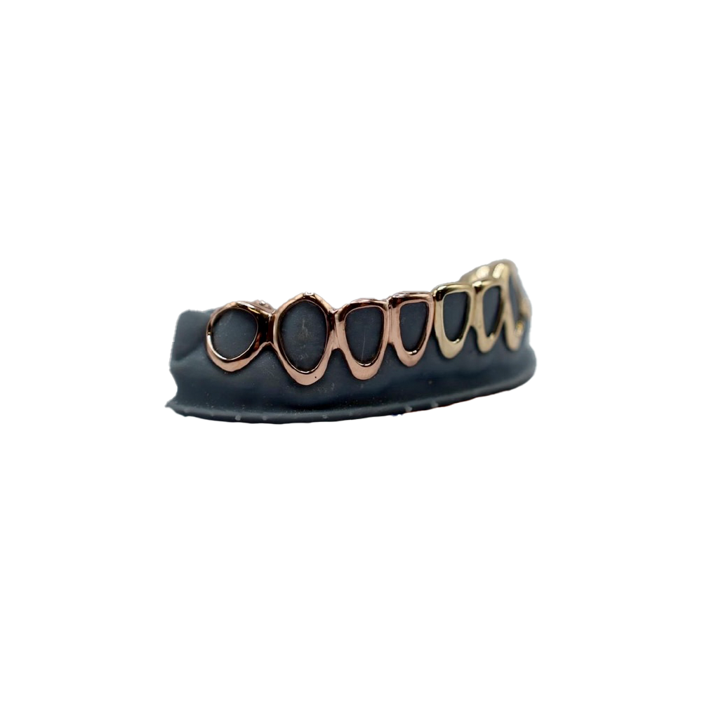 ANFRAGE: Custom - Gold GRILLZ
