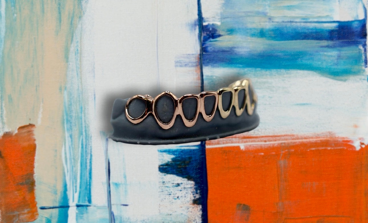 ANFRAGE: Custom - Gold GRILLZ