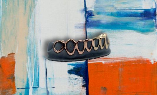 ANFRAGE: Custom - Gold GRILLZ